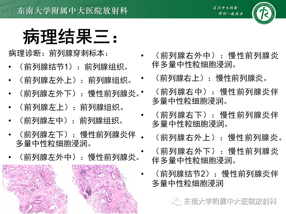 影像PPT - 【病例】前列腺病例随访讨论3例MR-7 影像PPT - 【病例】前列腺病例随访讨论3例MR-7