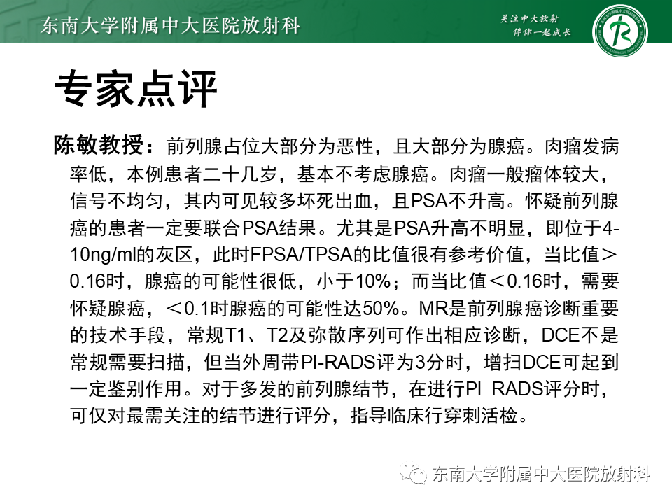 影像PPT - 【病例】前列腺病例随访讨论3例MR-8 影像PPT - 【病例】前列腺病例随访讨论3例MR-8