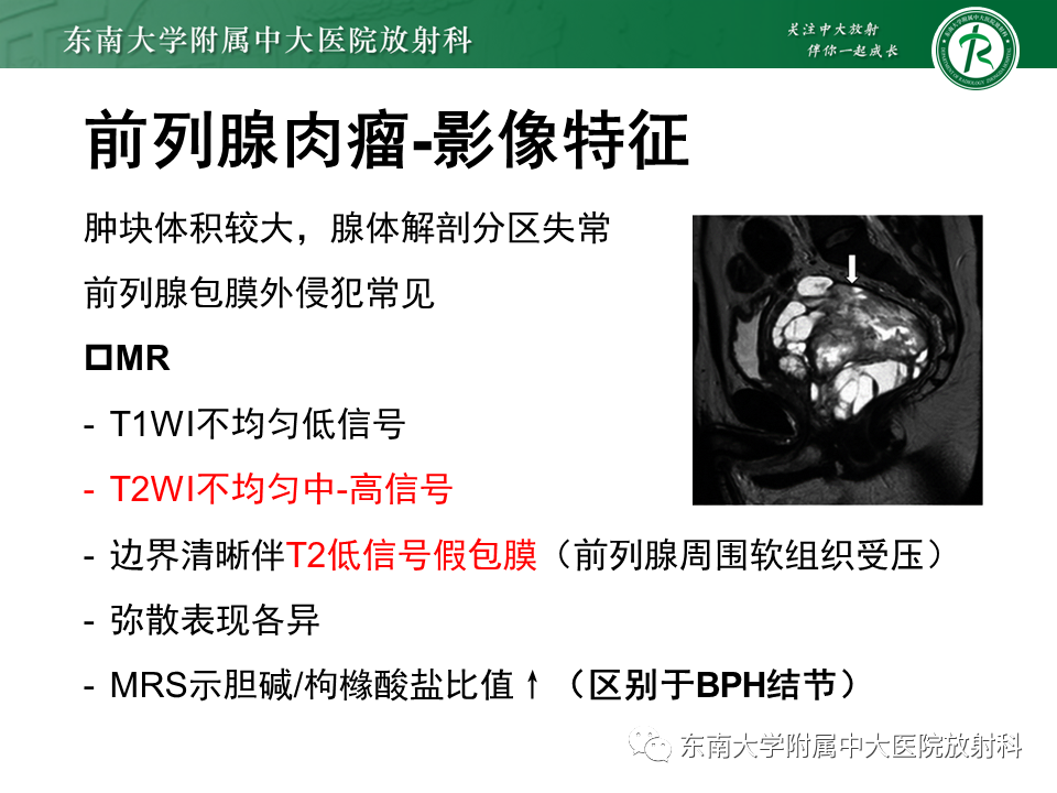 影像PPT - 【病例】前列腺病例随访讨论3例MR-13 影像PPT - 【病例】前列腺病例随访讨论3例MR-13