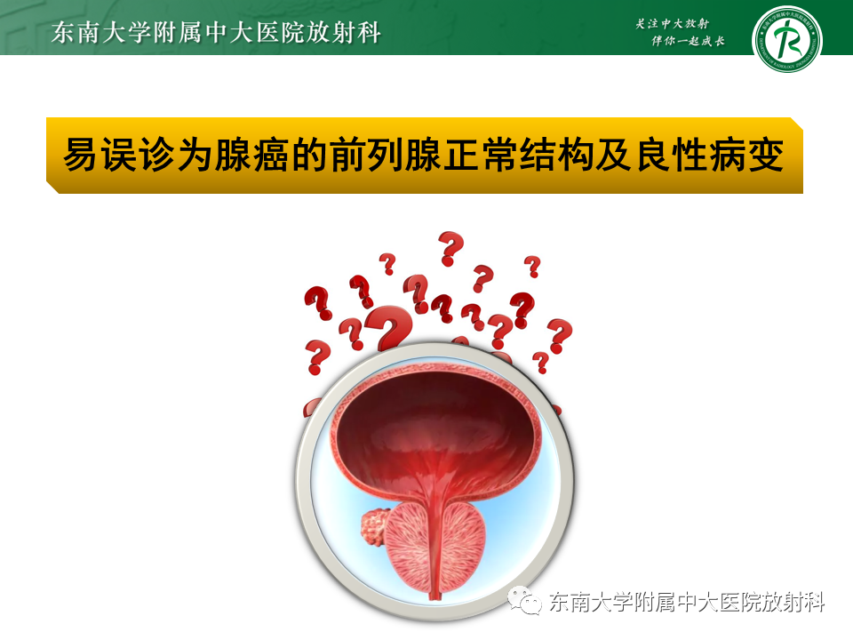 影像PPT - 【病例】前列腺病例随访讨论3例MR-17 影像PPT - 【病例】前列腺病例随访讨论3例MR-17