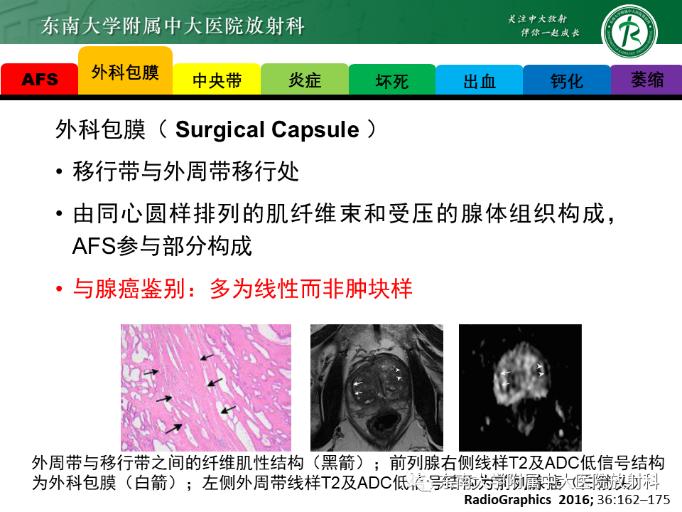 影像PPT - 【病例】前列腺病例随访讨论3例MR-19 影像PPT - 【病例】前列腺病例随访讨论3例MR-19