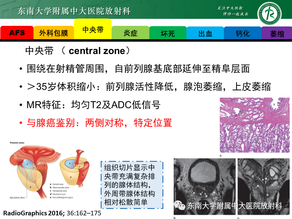 影像PPT - 【病例】前列腺病例随访讨论3例MR-20 影像PPT - 【病例】前列腺病例随访讨论3例MR-20