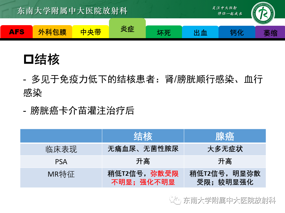 影像PPT - 【病例】前列腺病例随访讨论3例MR-23 影像PPT - 【病例】前列腺病例随访讨论3例MR-23