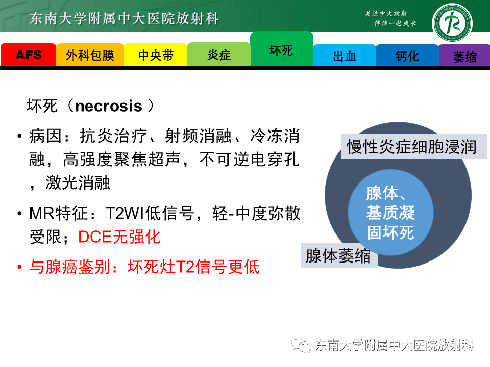 影像PPT - 【病例】前列腺病例随访讨论3例MR-25 影像PPT - 【病例】前列腺病例随访讨论3例MR-25