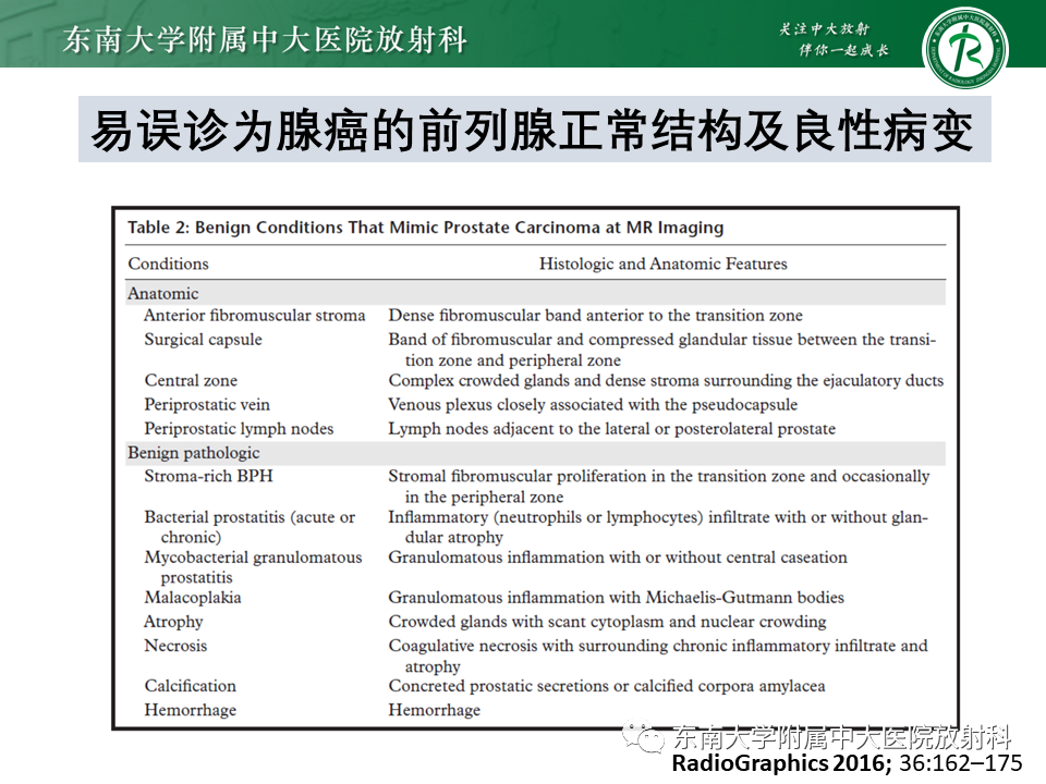 影像PPT - 【病例】前列腺病例随访讨论3例MR-30 影像PPT - 【病例】前列腺病例随访讨论3例MR-30