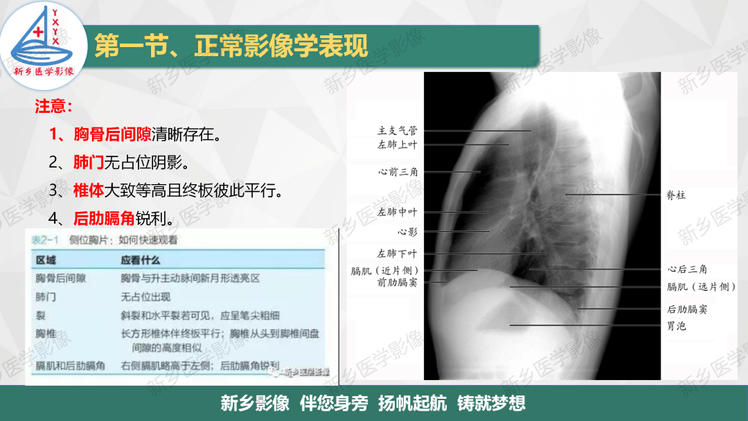 影像PPT - 【PPT】医学影像诊断学教材解读—呼吸系统疾病-4