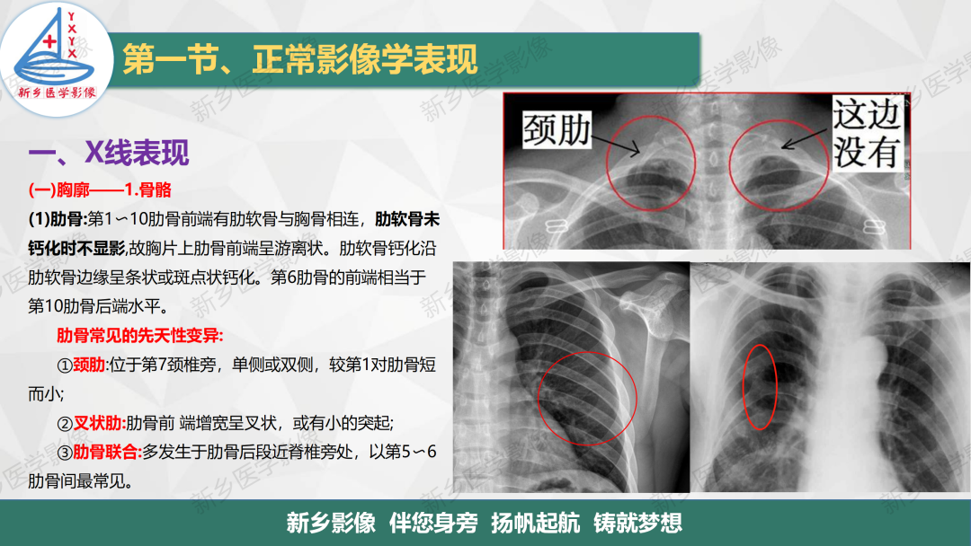 影像PPT - 【PPT】医学影像诊断学教材解读—呼吸系统疾病-5