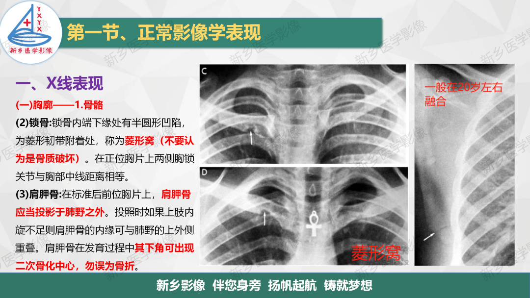 影像PPT - 【PPT】医学影像诊断学教材解读—呼吸系统疾病-6