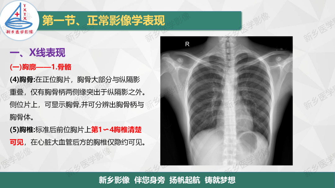 影像PPT - 【PPT】医学影像诊断学教材解读—呼吸系统疾病-7