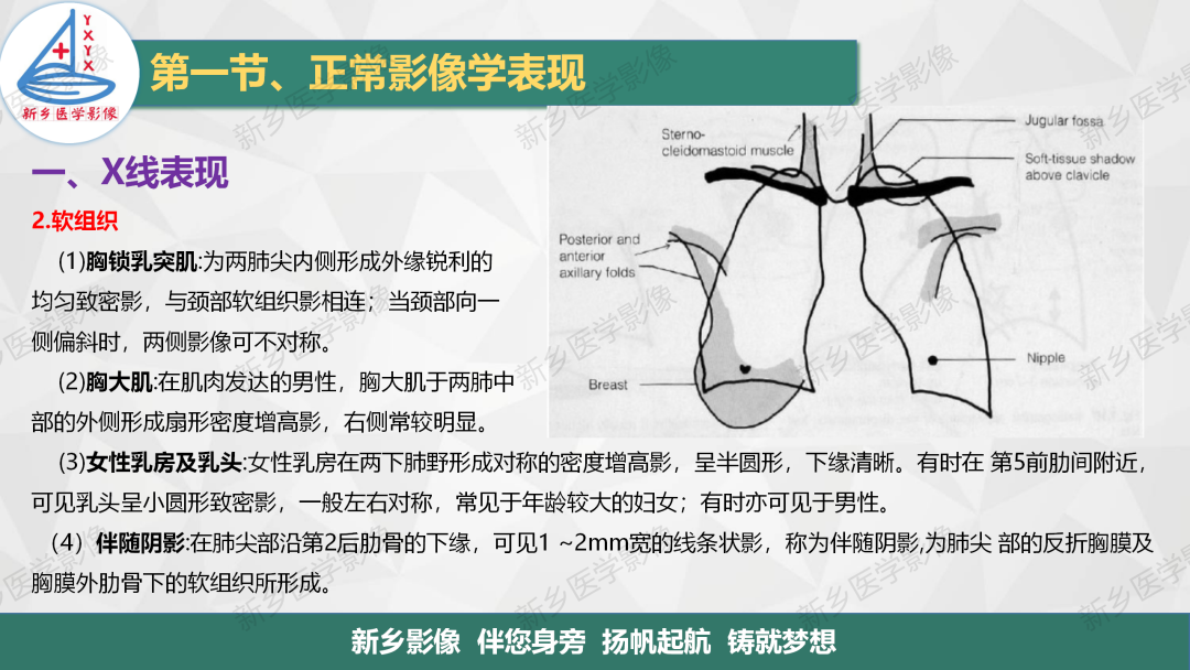 影像PPT - 【PPT】医学影像诊断学教材解读—呼吸系统疾病-8