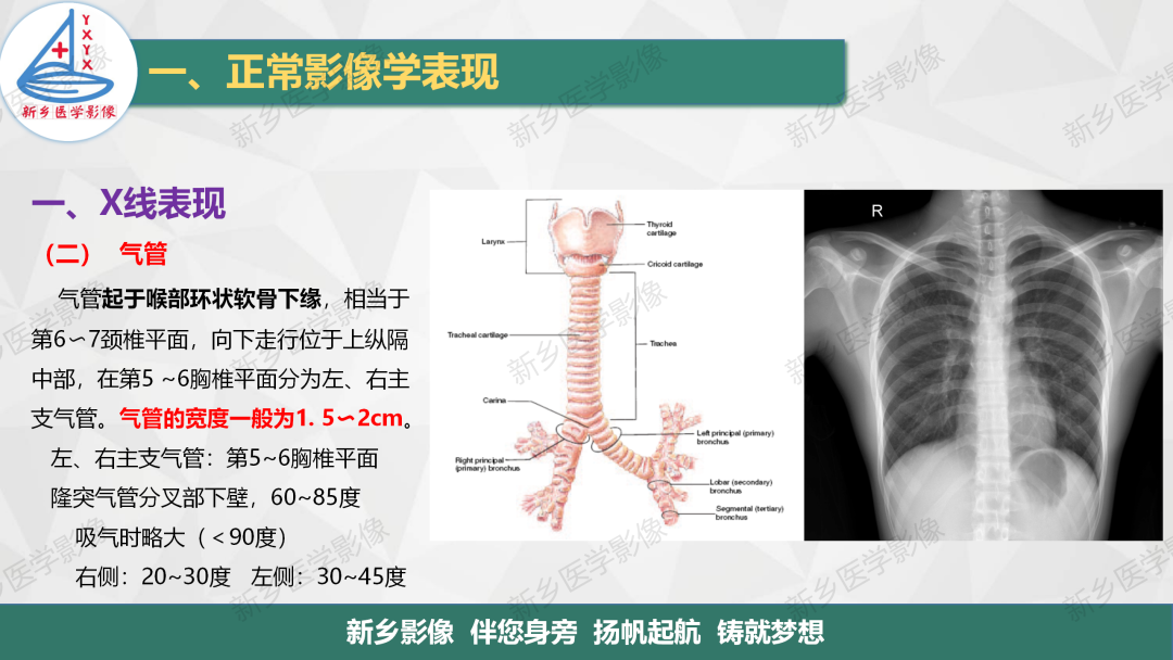 影像PPT - 【PPT】医学影像诊断学教材解读—呼吸系统疾病-10