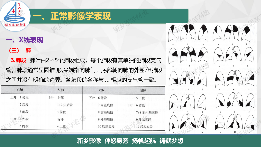 影像PPT - 【PPT】医学影像诊断学教材解读—呼吸系统疾病-14
