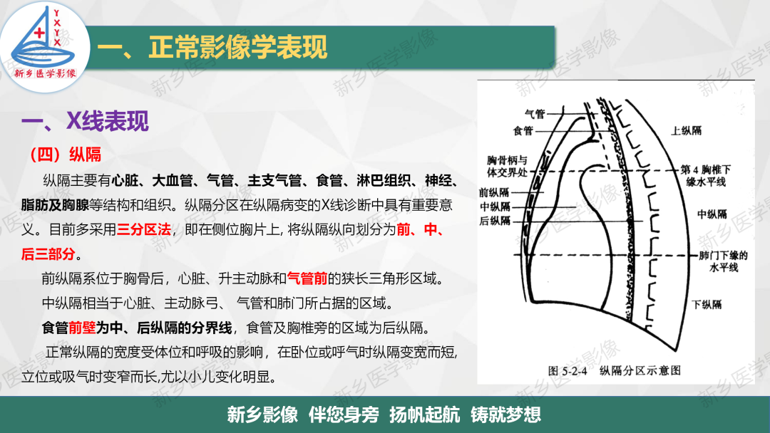 影像PPT - 【PPT】医学影像诊断学教材解读—呼吸系统疾病-23
