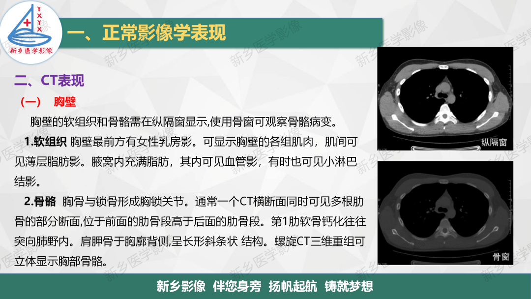 影像PPT - 【PPT】医学影像诊断学教材解读—呼吸系统疾病-27
