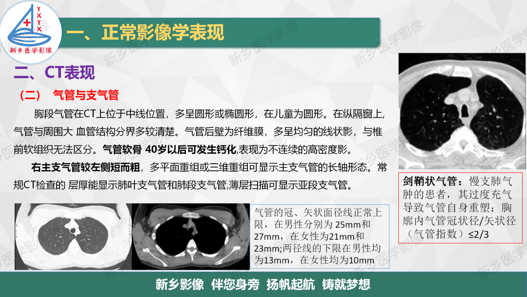 影像PPT - 【PPT】医学影像诊断学教材解读—呼吸系统疾病-28