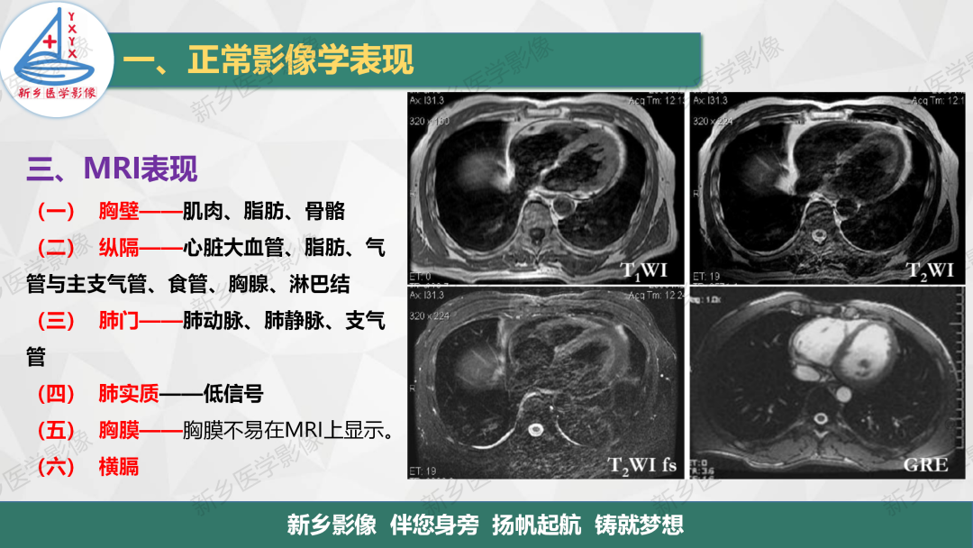 影像PPT - 【PPT】医学影像诊断学教材解读—呼吸系统疾病-43