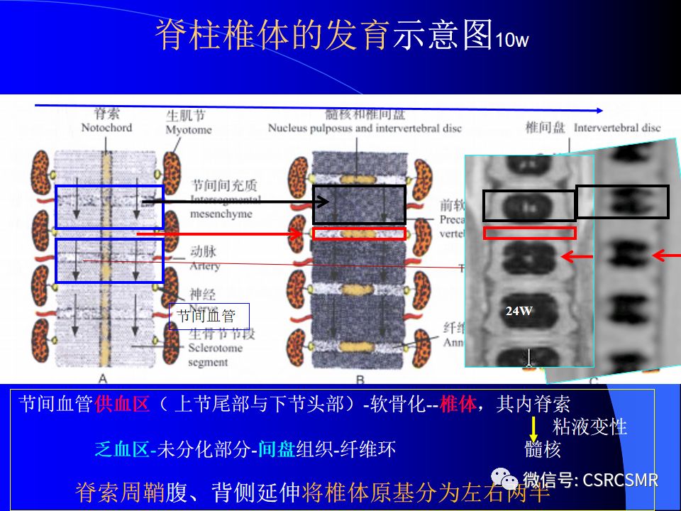 影像PPT - 【PPT】椎间盘发育、退变与病变MRI表现-4