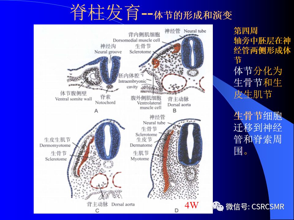 影像PPT - 【PPT】椎间盘发育、退变与病变MRI表现-3
