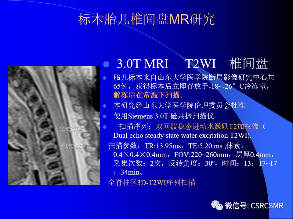 影像PPT - 【PPT】椎间盘发育、退变与病变MRI表现-7