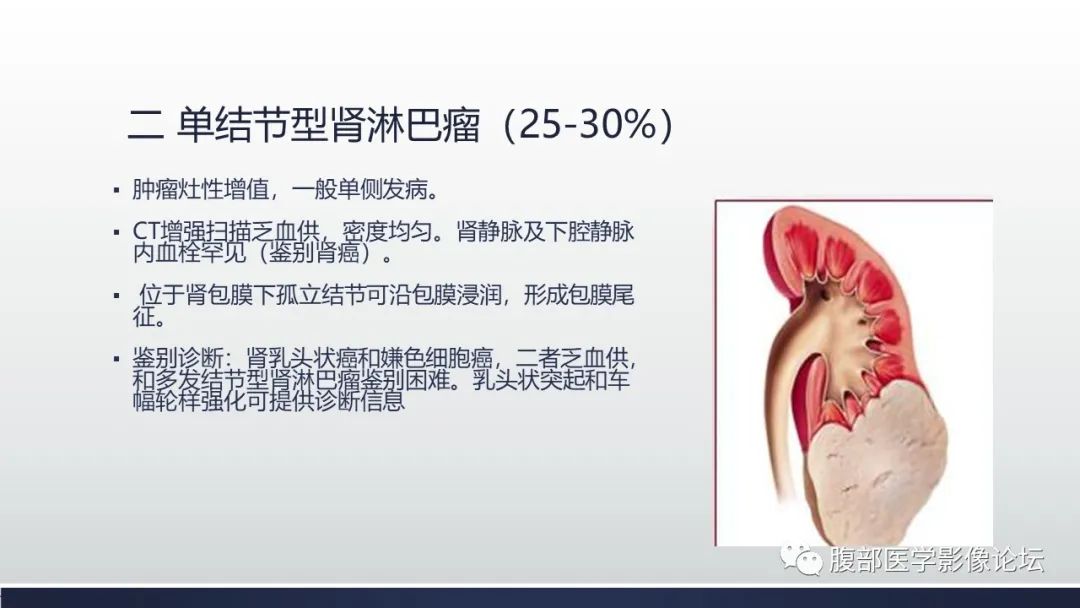 影像PPT - 【PPT】肾脏淋巴瘤1例CT及MR-10