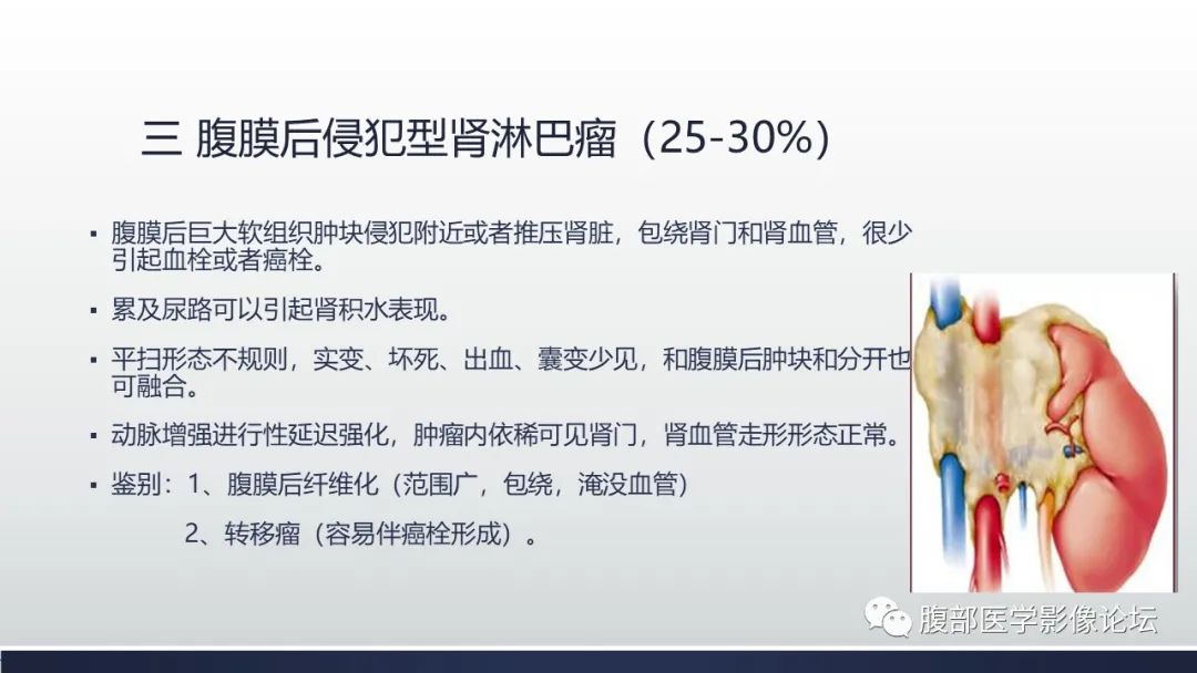 影像PPT - 【PPT】肾脏淋巴瘤1例CT及MR-12