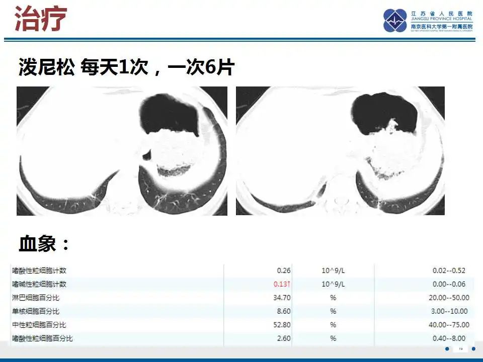 影像PPT - 【PPT】嗜酸性肉芽肿性多血管炎-20