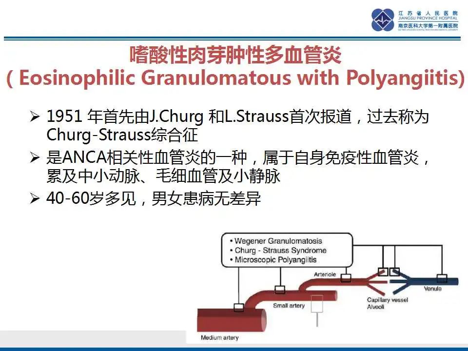 影像PPT - 【PPT】嗜酸性肉芽肿性多血管炎-21