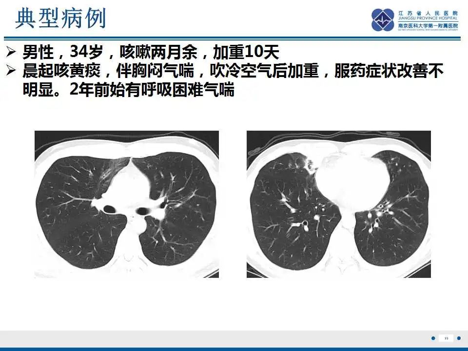 影像PPT - 【PPT】嗜酸性肉芽肿性多血管炎-34