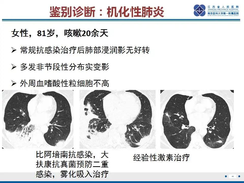 影像PPT - 【PPT】嗜酸性肉芽肿性多血管炎-41