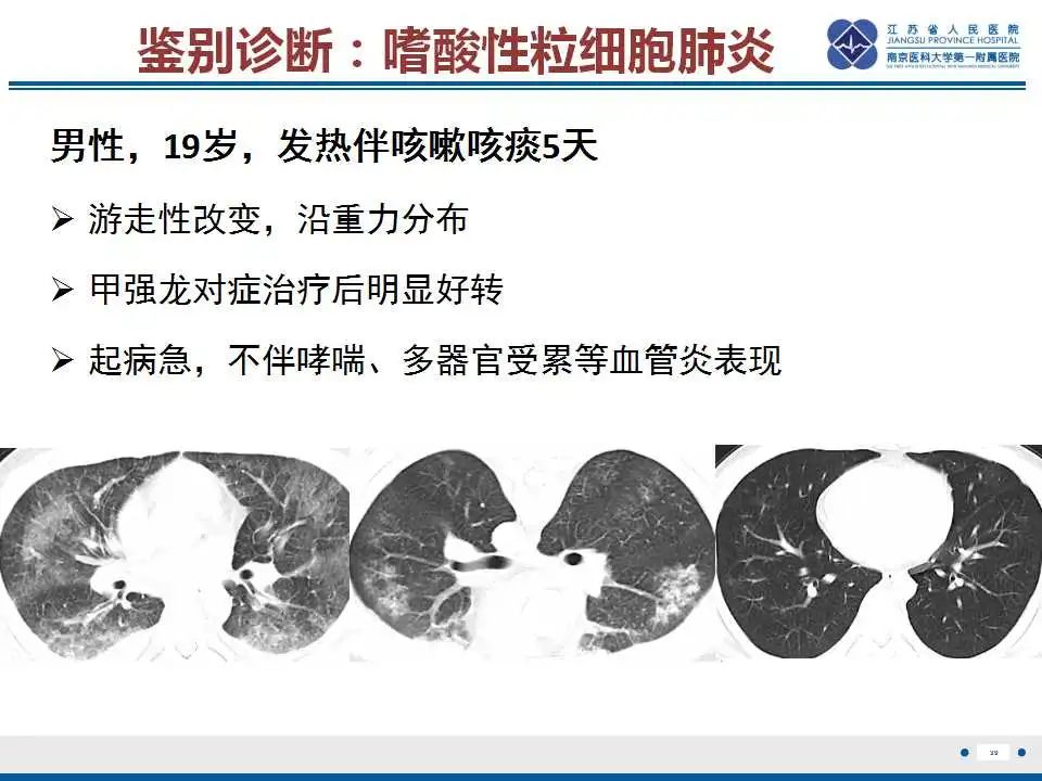 影像PPT - 【PPT】嗜酸性肉芽肿性多血管炎-40