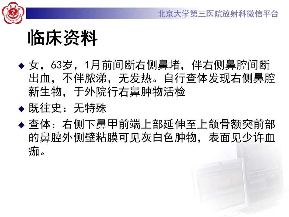 影像PPT - 【PPT】鼻腔鼻窦恶性黑色素瘤-2