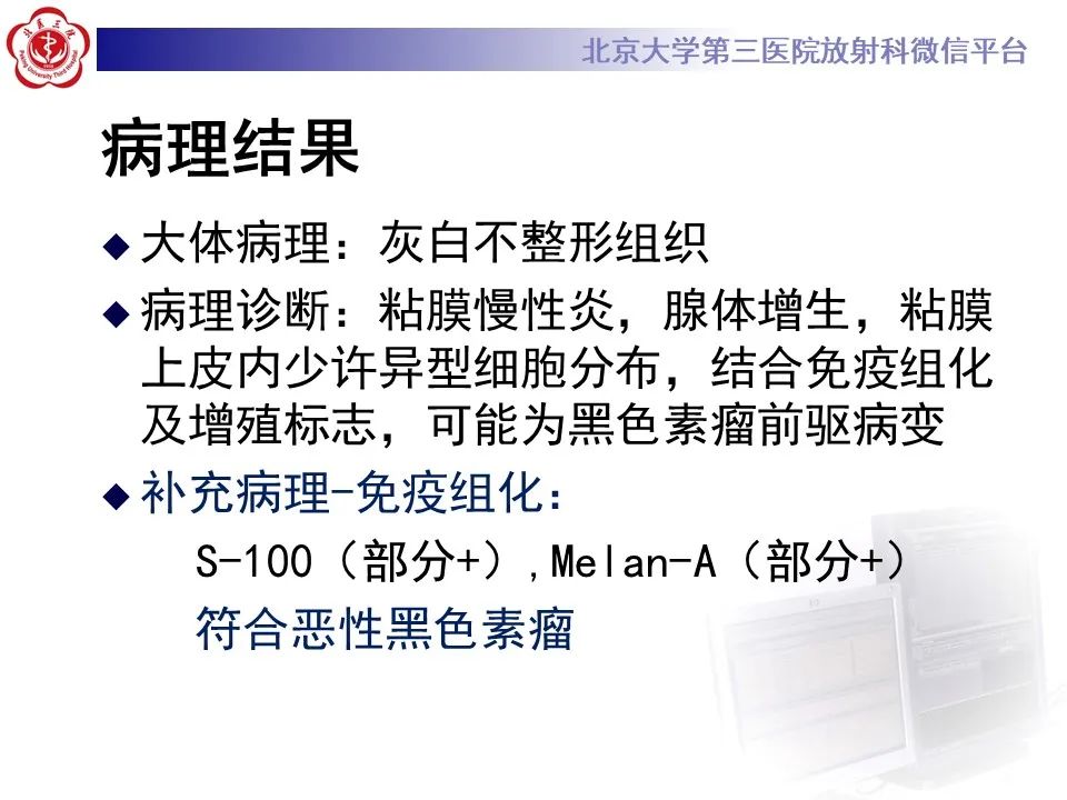 影像PPT - 【PPT】鼻腔鼻窦恶性黑色素瘤-6