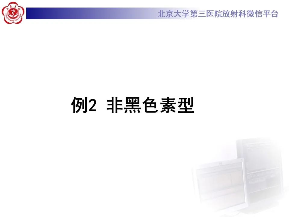 影像PPT - 【PPT】鼻腔鼻窦恶性黑色素瘤-19