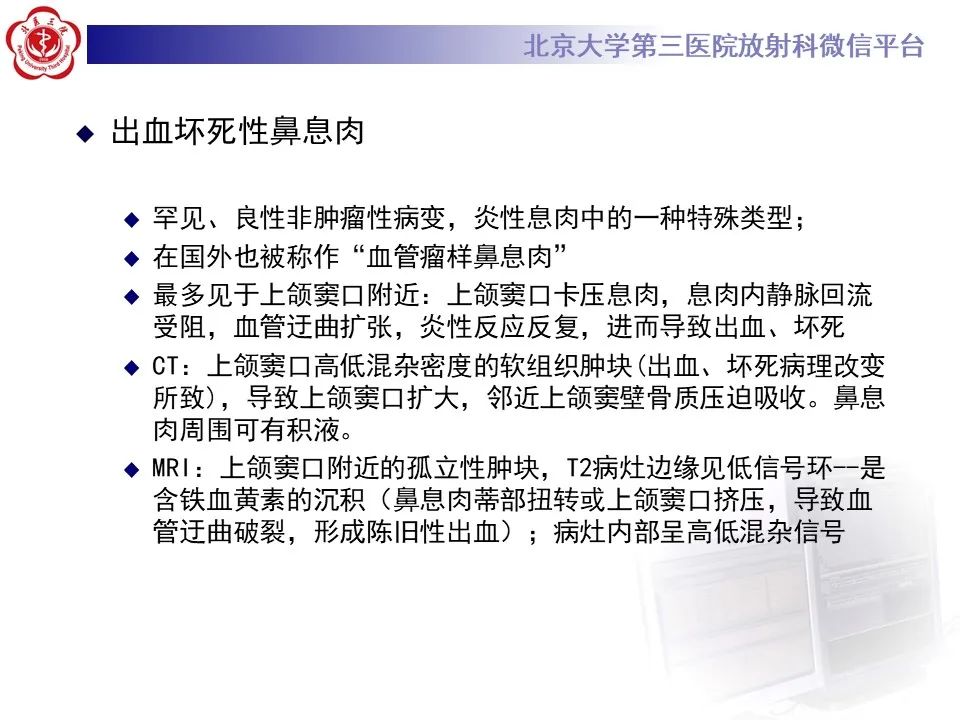 影像PPT - 【PPT】鼻腔鼻窦恶性黑色素瘤-24