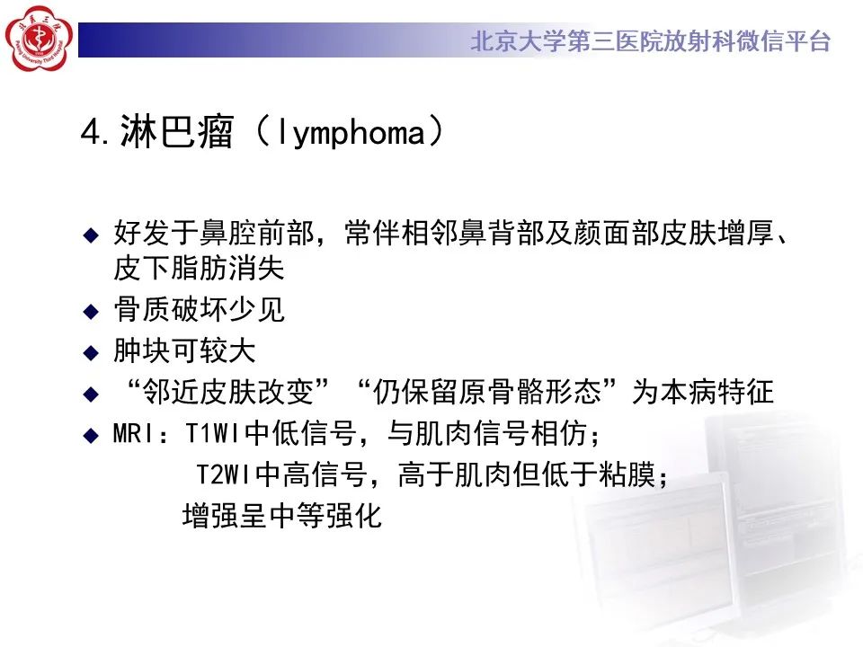 影像PPT - 【PPT】鼻腔鼻窦恶性黑色素瘤-30