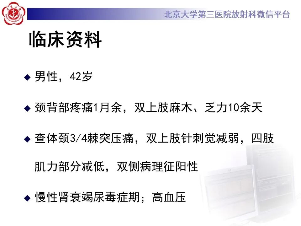 影像PPT - 【PPT】脊柱棕色瘤-2