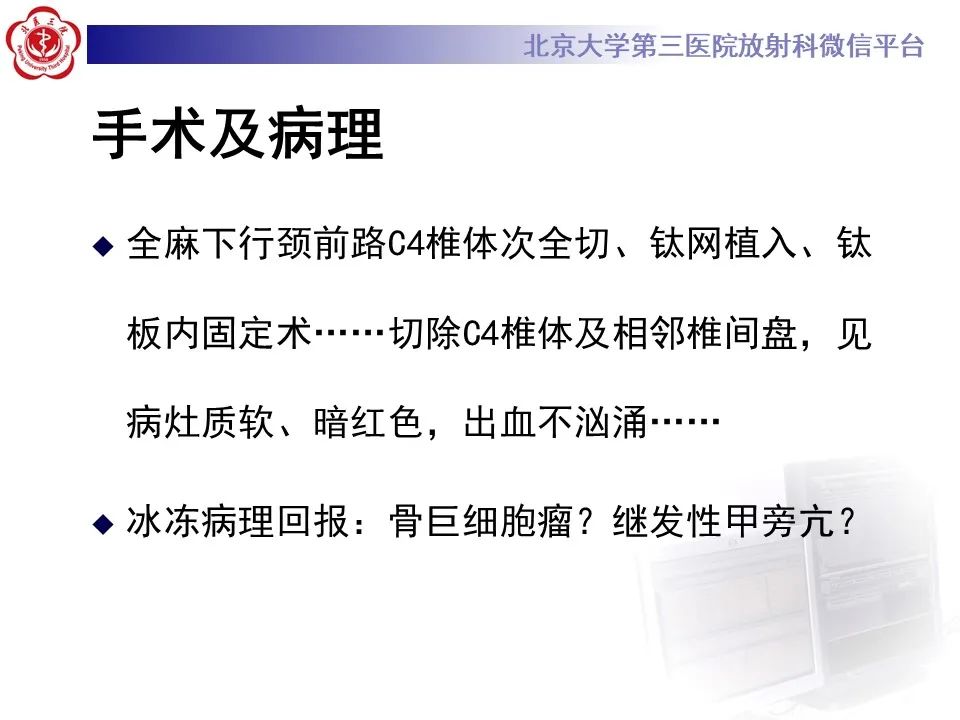 影像PPT - 【PPT】脊柱棕色瘤-8