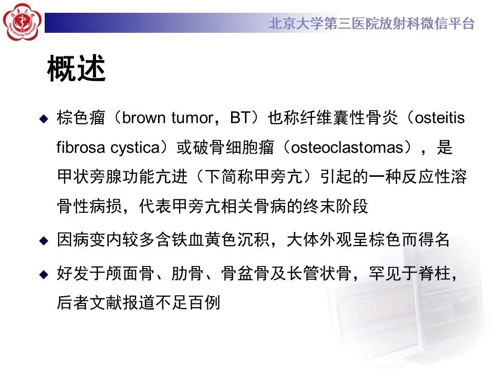 影像PPT - 【PPT】脊柱棕色瘤-10