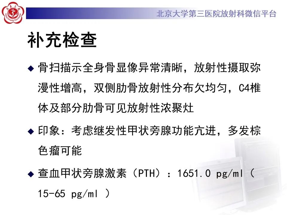 影像PPT - 【PPT】脊柱棕色瘤-7