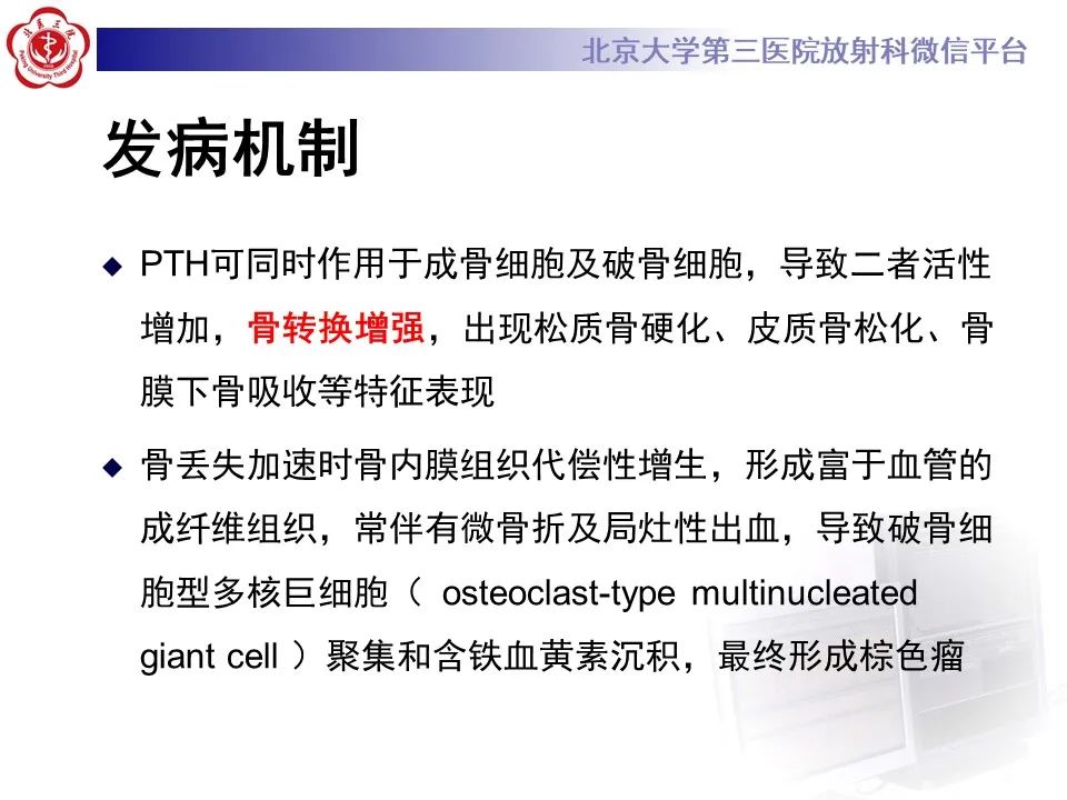 影像PPT - 【PPT】脊柱棕色瘤-12