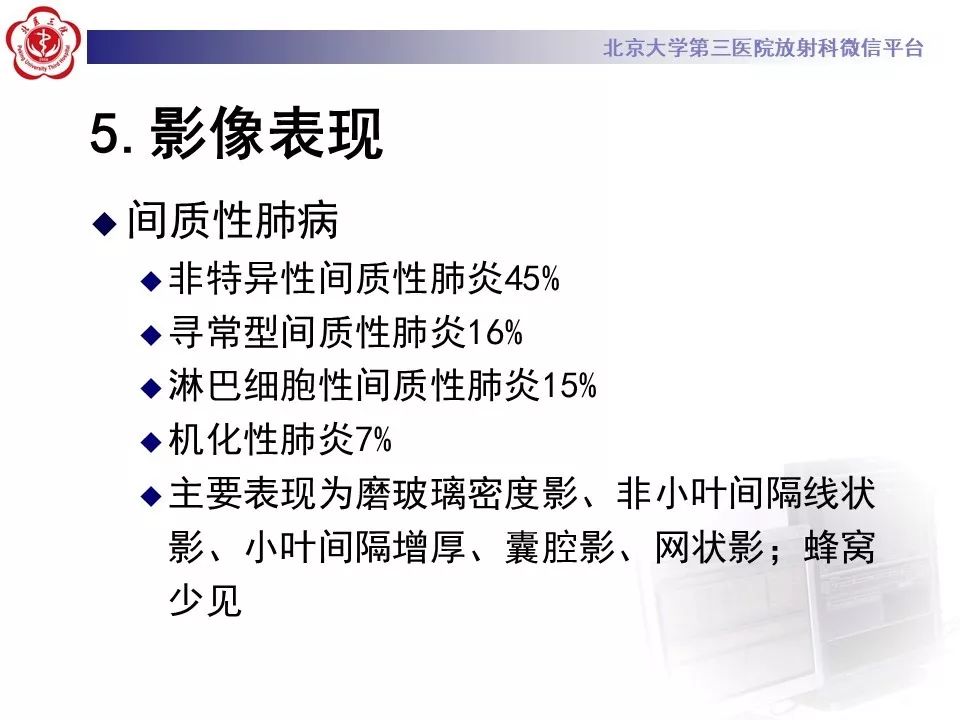 影像PPT - 【PPT】干燥综合征肺部表现-22