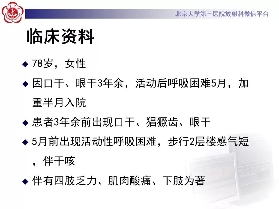 影像PPT - 【PPT】干燥综合征肺部表现-2