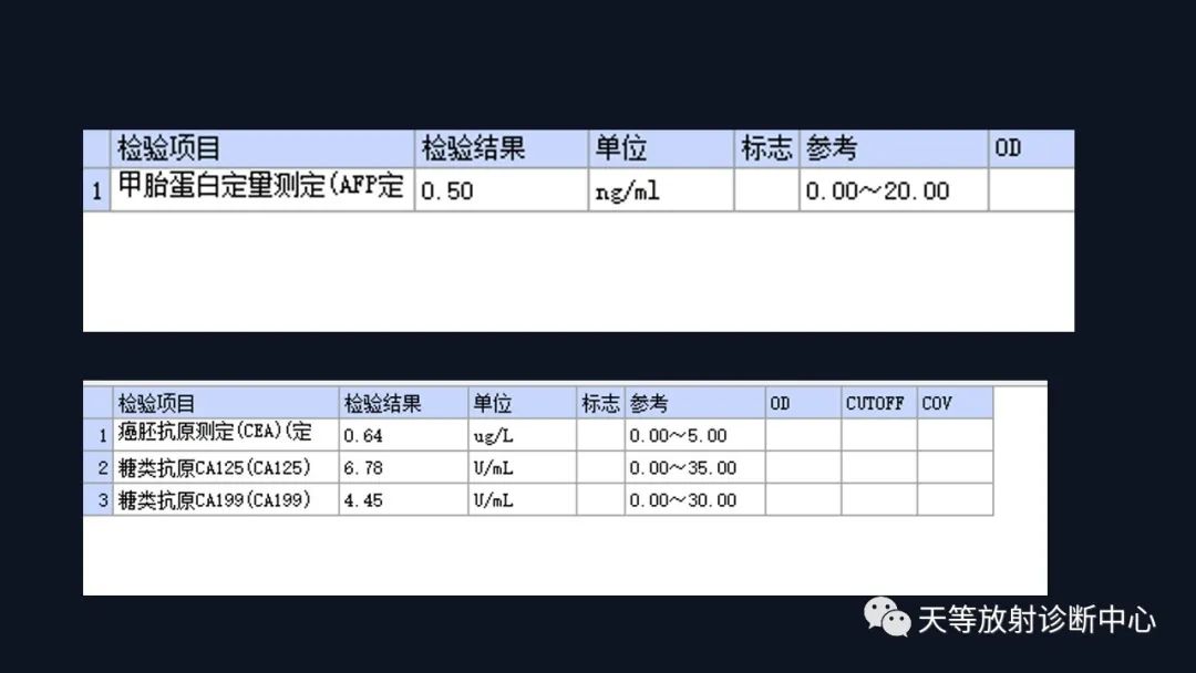 影像PPT - 【病例】播散性腹膜平滑肌瘤病1例MR-15 影像PPT - 【病例】播散性腹膜平滑肌瘤病1例MR-15