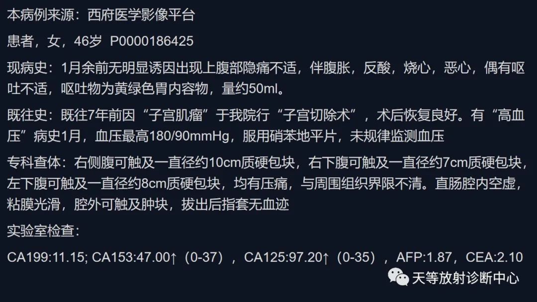 影像PPT - 【病例】播散性腹膜平滑肌瘤病1例MR-28 影像PPT - 【病例】播散性腹膜平滑肌瘤病1例MR-28