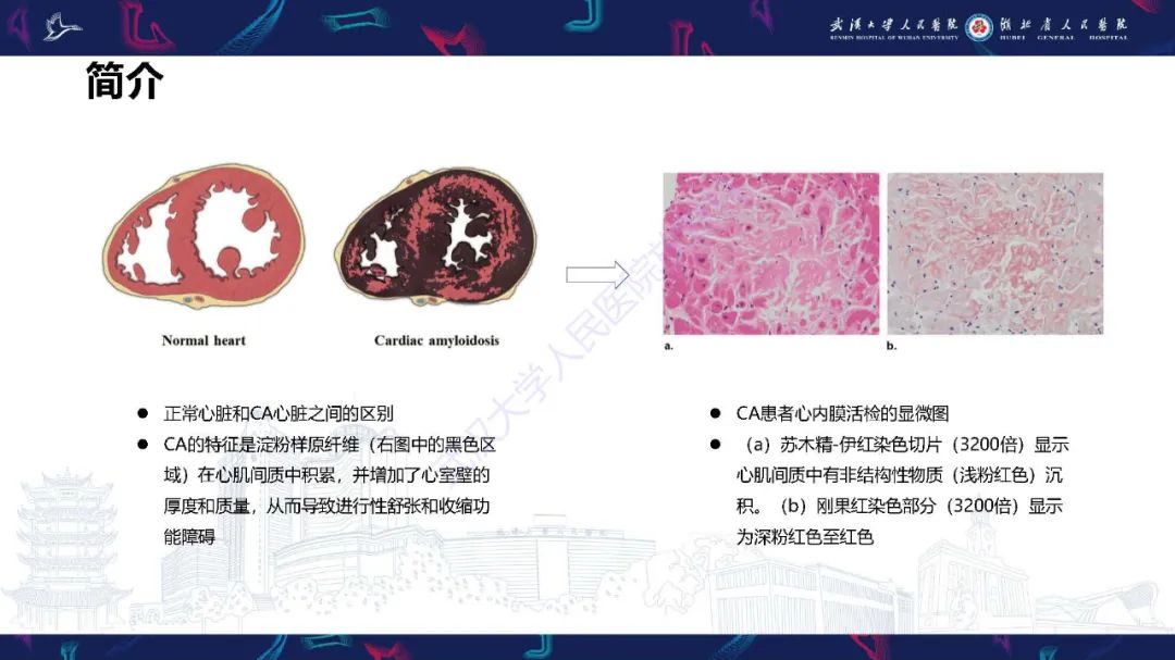 影像PPT - 【PPT】心肌淀粉样变影像诊断-5