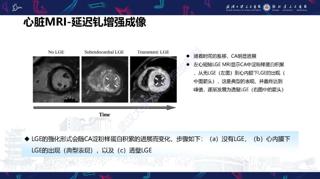 影像PPT - 【PPT】心肌淀粉样变影像诊断-23