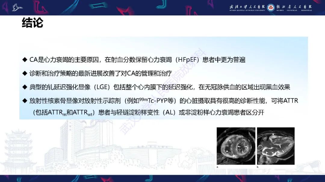 影像PPT - 【PPT】心肌淀粉样变影像诊断-39