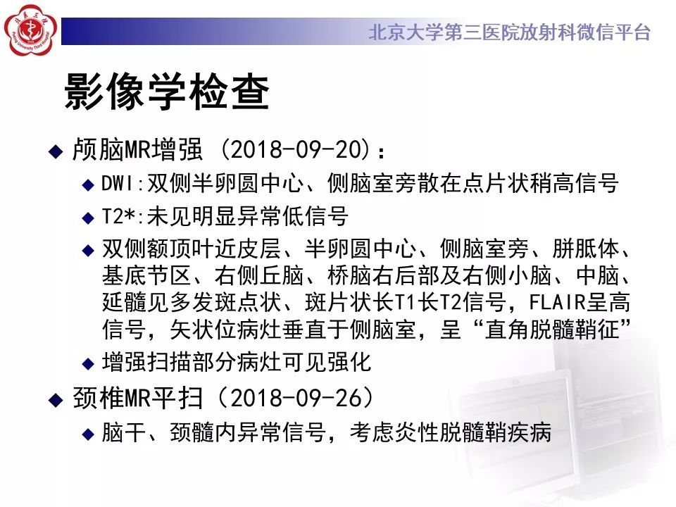 影像PPT - 【PPT】多发性硬化的影像-15