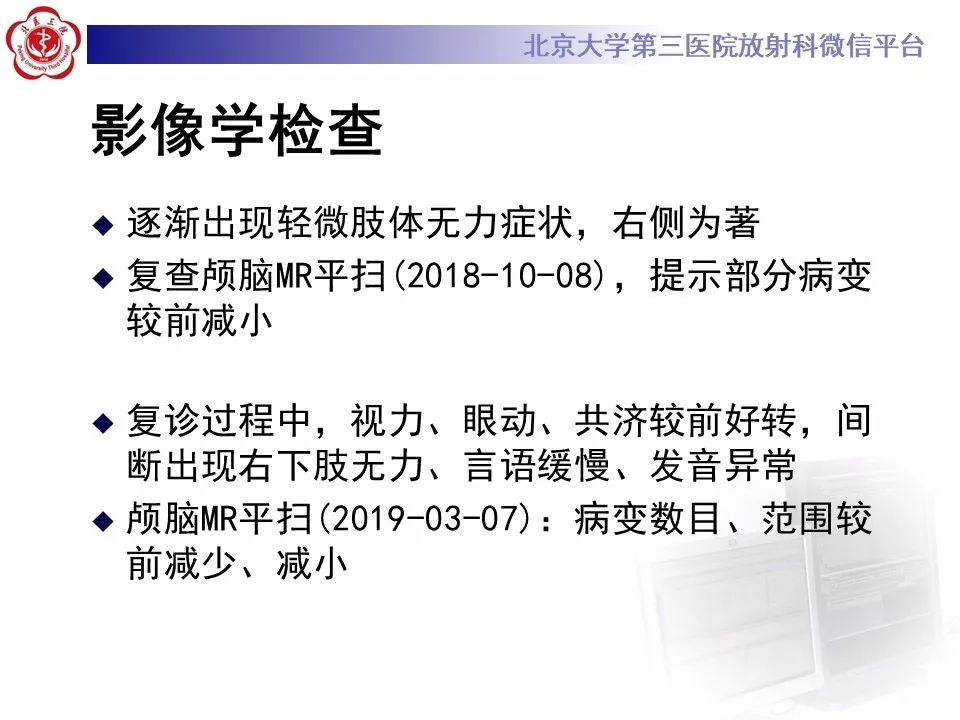 影像PPT - 【PPT】多发性硬化的影像-17