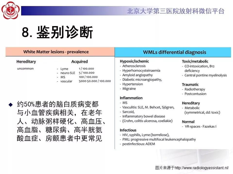 影像PPT - 【PPT】多发性硬化的影像-46